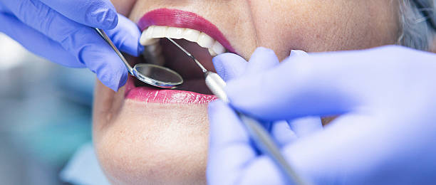 Best Emergency Treatment for Oral Infections in Branson, MO